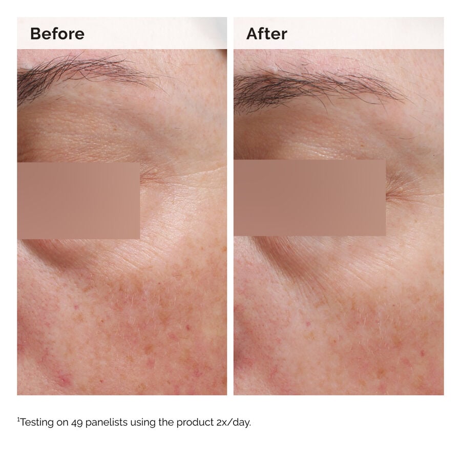 niacinamide-5-face-and-body-emulsion-w9 2024-08-23-ORD-Nia-5pct-Face-Body-B-A-Elasticity-Global-02-1x1.jpg