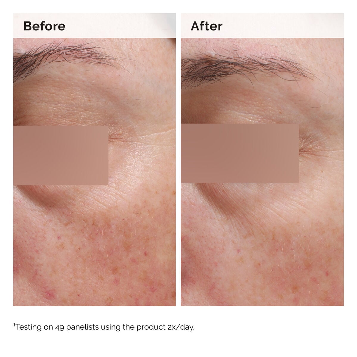 niacinamide-5-face-and-body-emulsion-w9 2024-08-23-ORD-Nia-5pct-Face-Body-B-A-Elasticity-Global-02-1x1.jpg