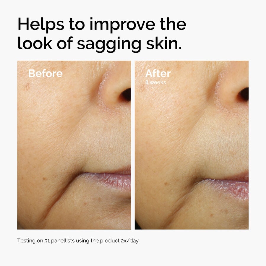 caffeine-3-escin-1-face-serum-u7 ord-caffeine-3pct-escin-1pct-face-serum-before-after-sagging.jpg