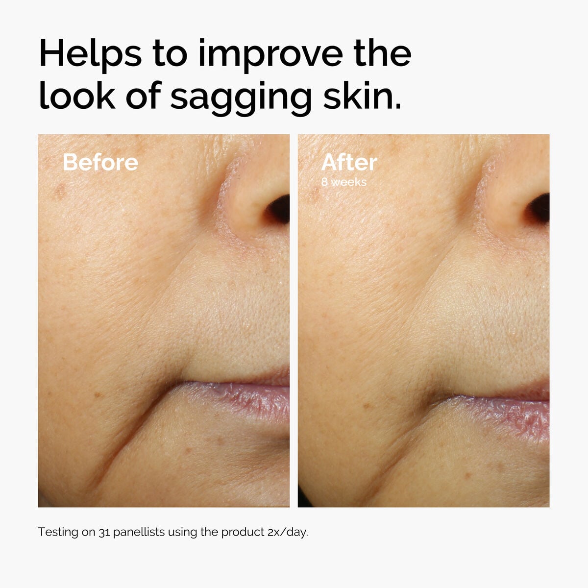 caffeine-3-escin-1-face-serum-u7 ord-caffeine-3pct-escin-1pct-face-serum-before-after-sagging.jpg