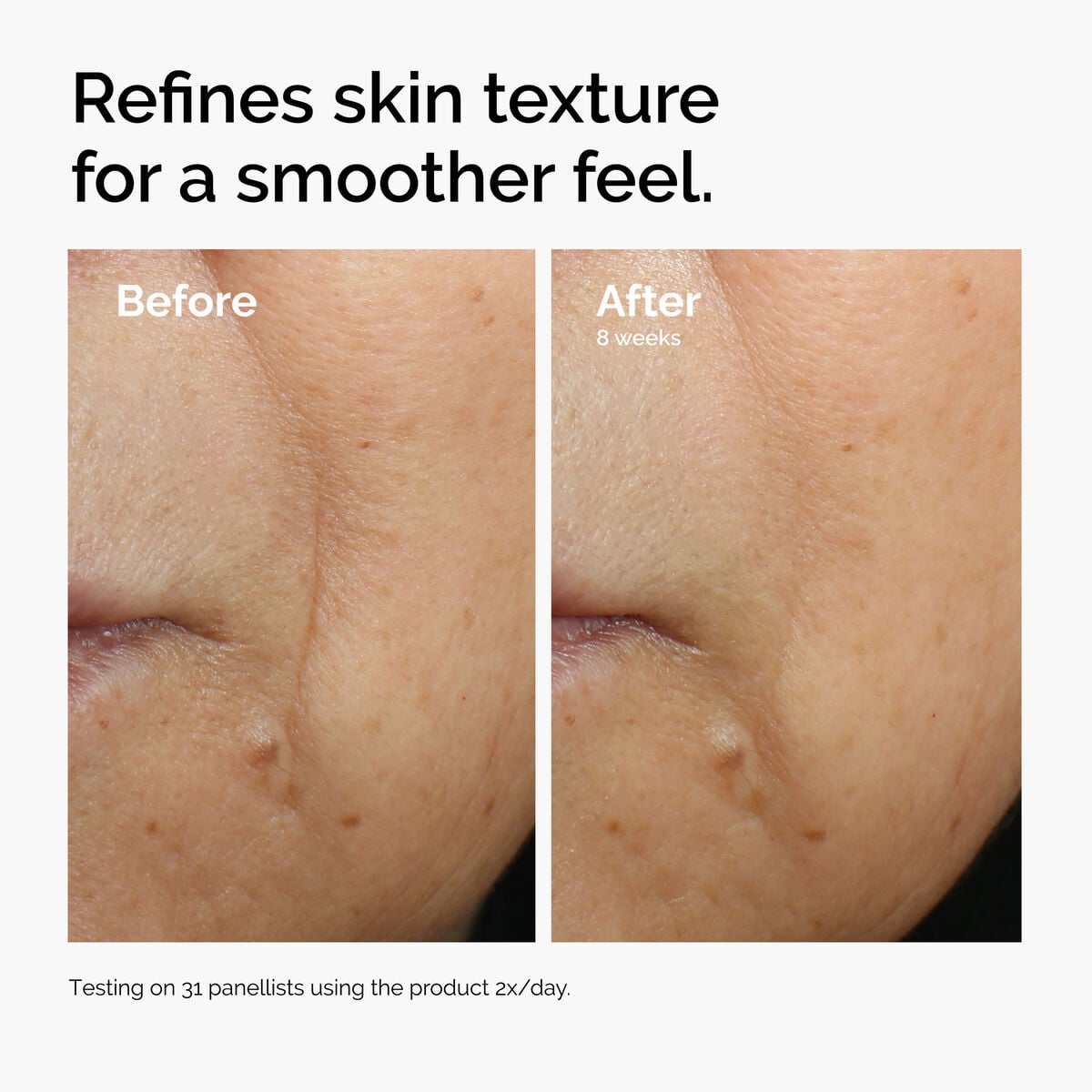 caffeine-3-escin-1-face-serum-u7 ord-caffeine-3pct-escin-1pct-face-serum-before-after-texture.jpg