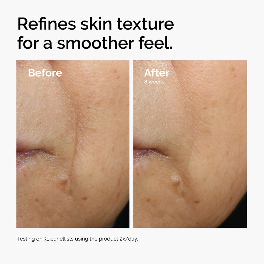 caffeine-3-escin-1-face-serum-u7 ord-caffeine-3pct-escin-1pct-face-serum-before-after-texture.jpg