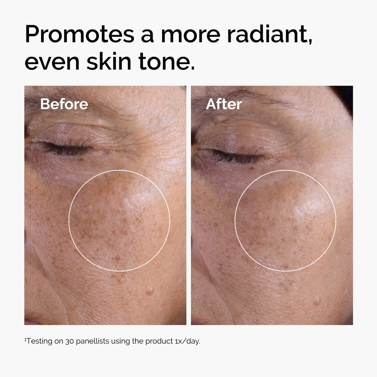 glycolic-acid-7-exfoliating-toner-r4 ord-glycolic-before-after-radiance.jpg