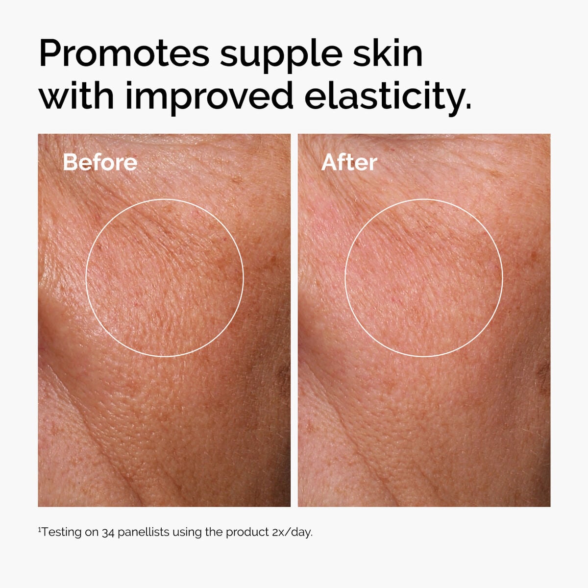 hyaluronic-acid-2-b5-with-ceramides-e6 ord-hyaluronic-acid-2pct-b5-hydrating-serum-before-after-elasticity.jpg