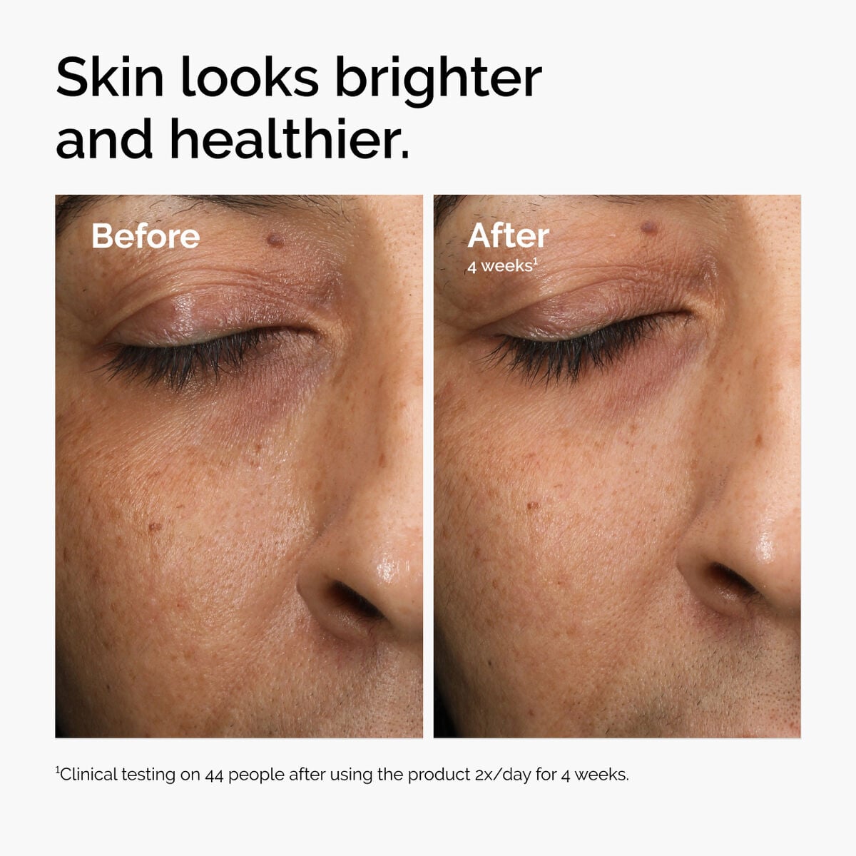 multi-antioxidant-radiance-serum-v7 ord-mars-before-after-healthy.jpg