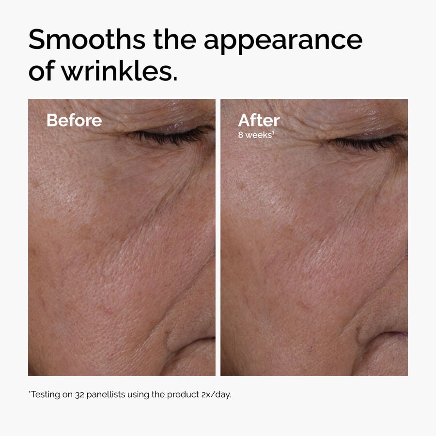 multi-peptide-ha-serum-w1 ord-multi-peptide-ha-serum-wrinkles-before-after.jpg