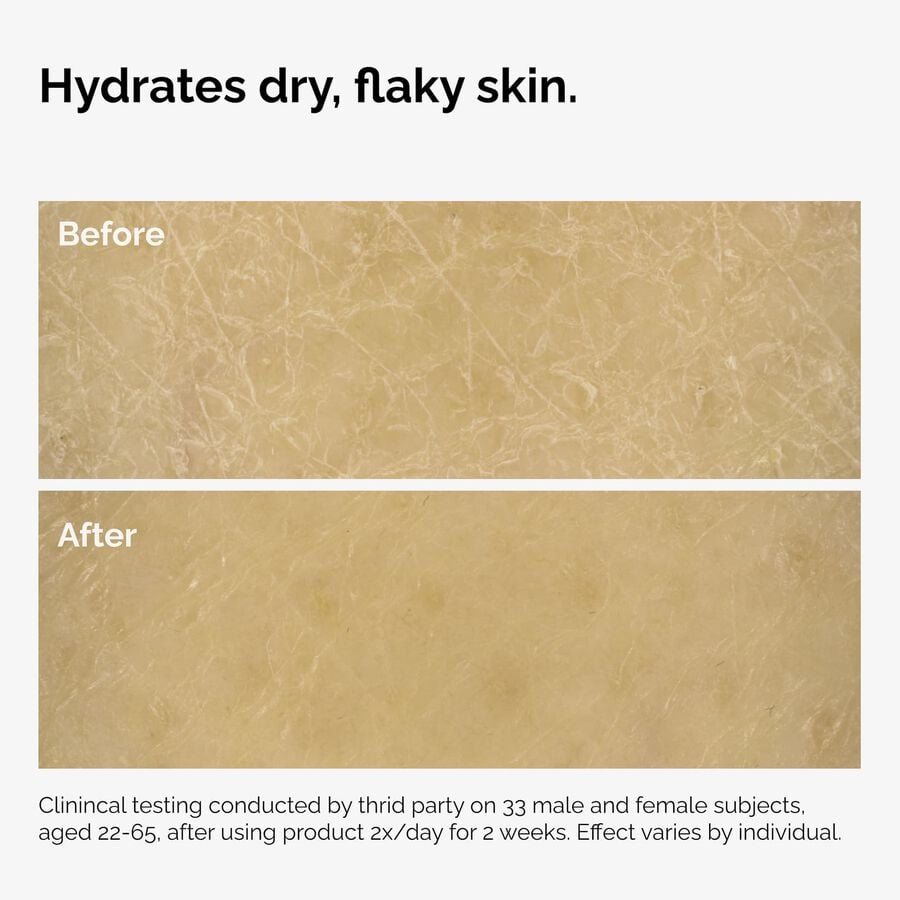 the-body-care-collection-o0 ord-natural-moisturizing-factors-inulin-body-before-after-graphic-02.jpg