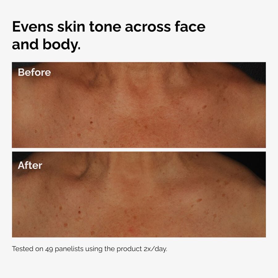 the-body-care-collection-o0 ord-niacinamide-face-body-serum-before-after-even-tone-graphic.jpg