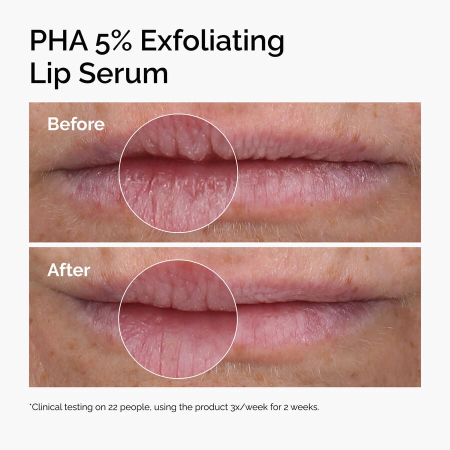 pha-5-exfoliating-lip-serum-z1 ord-pha-5pct-lip-exfoliating-serum-before-after.jpg