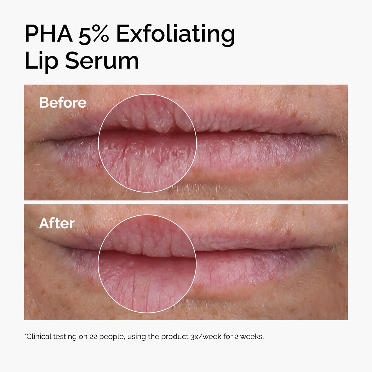 pha-5-exfoliating-lip-serum-z1 ord-pha-5pct-lip-exfoliating-serum-before-after.jpg